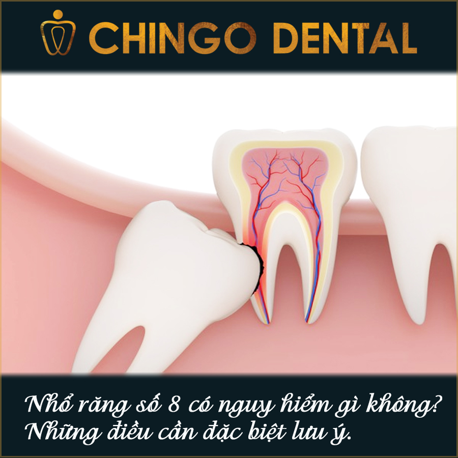 Nho Rang So 8 Chingo Dental