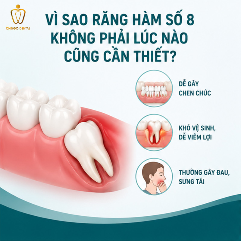 Nhổ Răng Số 8 Có Ảnh Hưởng Gì Không? Sự Thật Bác Sĩ Muốn Bạn Biết Trước Khi Quyết Định 1 nhổ răng số 8 có ảnh hưởng gì không