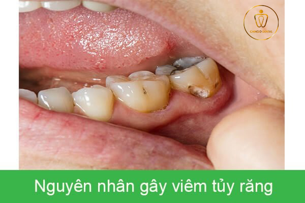 Tuy Rang Chingo Dental 2