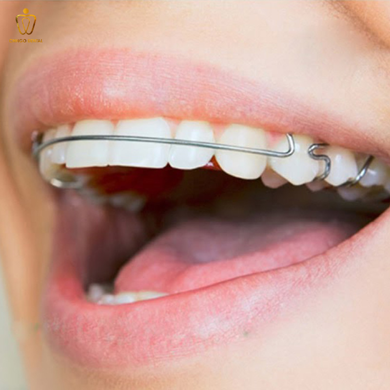 chi phí niềng răng hô