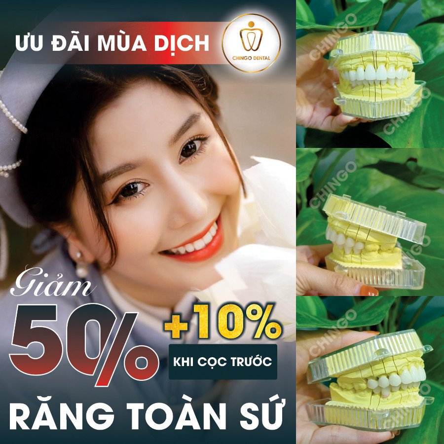 Dat Coc Cang Som Uu Dai Cang Nhieu Chingo Dental 1