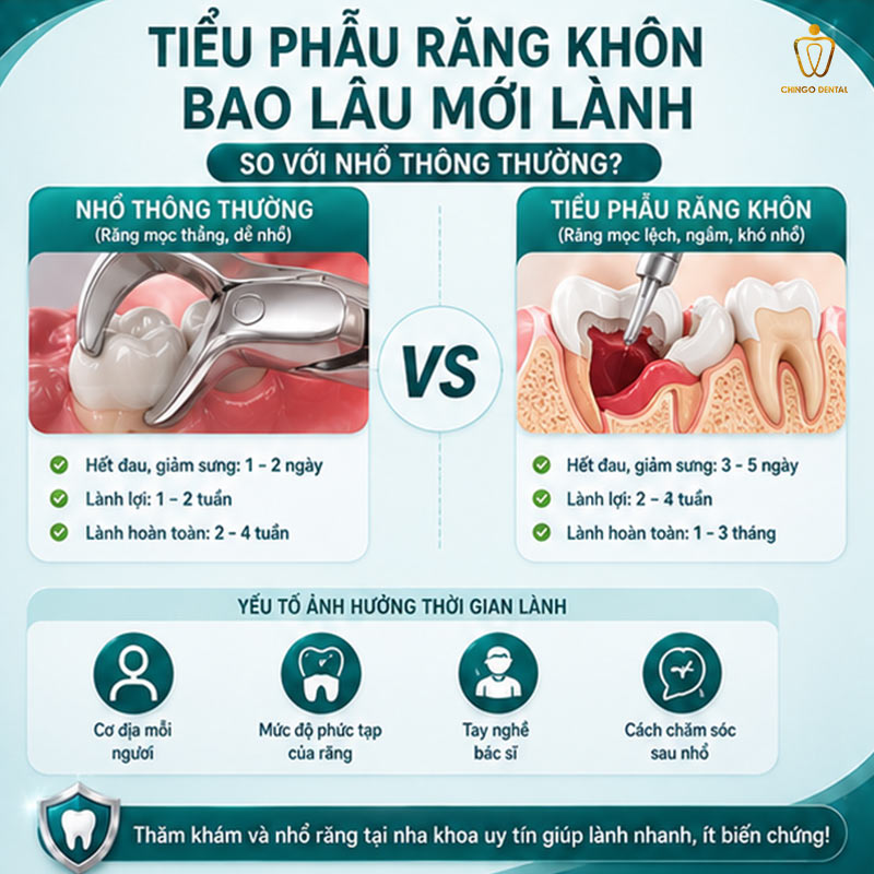 Nhổ Răng Khôn Bao Lâu Thì Lành? Toàn Bộ Thông Tin Cần Biết Trước Khi Nhổ 3 nhổ răng bao lâu thì lành