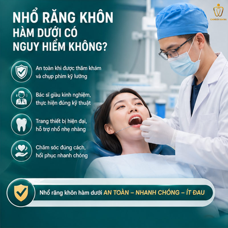 Nhổ Răng Khôn Hàm Dưới: Khi Nào Cần Nhổ, Quy Trình & Chi Phí Tại Chingo Dental 3 nhổ răng hàm dưới