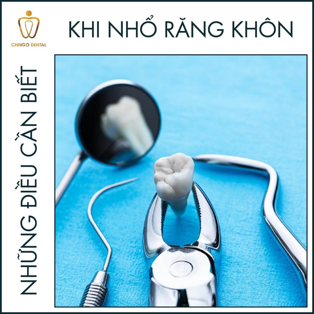 Nho Rang Khon Chingo Dental