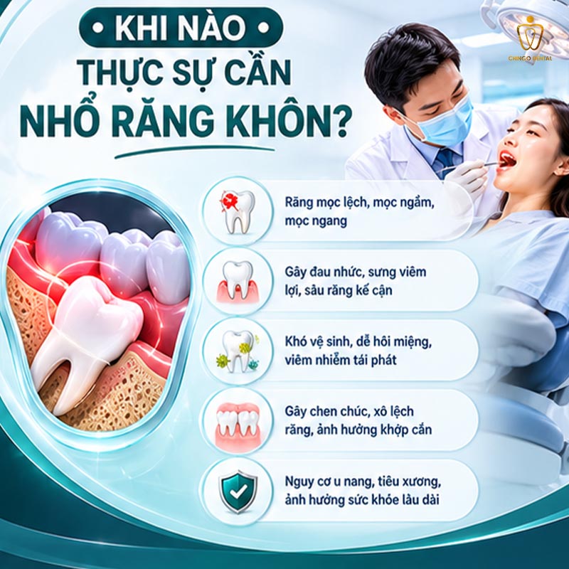 Nhổ Răng Khôn: Chi Phí, Quy Trình Và Tất Cả Những Điều Cần Biết Trước Khi Đi 2 nhổ răng khôn hết bao nhiêu