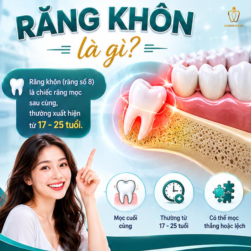 Nhổ Răng Khôn: Chi Phí, Quy Trình Và Tất Cả Những Điều Cần Biết Trước Khi Đi 1 nhổ răng khôn