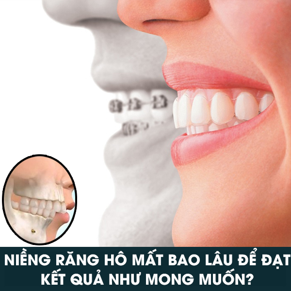 Nieng Rang Ho Chingo Dental