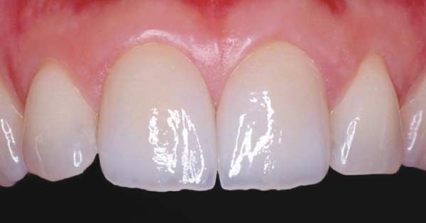 Tin Nha Khoa Chingo Dental 2
