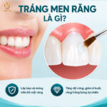 Tráng Men Răng Là Gì? Chi Phí, Quy Trình Và Địa Chỉ Uy Tín Tại Hà Nội - Đà Nẵng tráng men răng