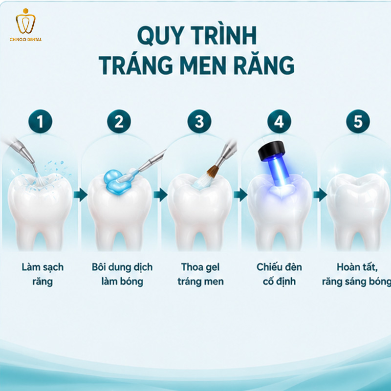 Tráng Men Răng Là Gì? Chi Phí, Quy Trình Và Địa Chỉ Uy Tín Tại Hà Nội - Đà Nẵng 3 tráng men răng bao nhiêu tiền