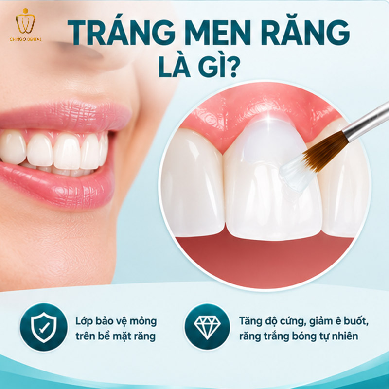 Tráng Men Răng Là Gì? Chi Phí, Quy Trình Và Địa Chỉ Uy Tín Tại Hà Nội - Đà Nẵng 47 tráng men răng