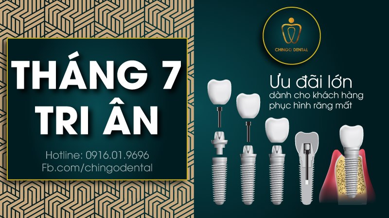 Thang 7 - Thang tri an - Chingo Dental - trong implant