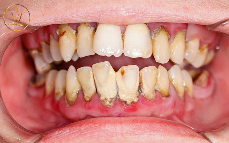 bản tin nha khoa số 4