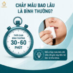 Cách Cầm Máu Khi Nhổ Răng: Hướng Dẫn Nhanh Và Đúng Cách cách cầm máu khi nhổ răng