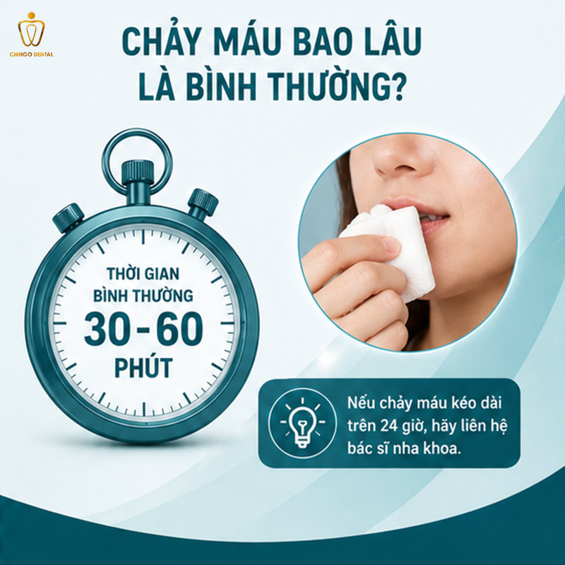 Cách Cầm Máu Khi Nhổ Răng: Hướng Dẫn Nhanh Và Đúng Cách 25 cách cầm máu khi nhổ răng