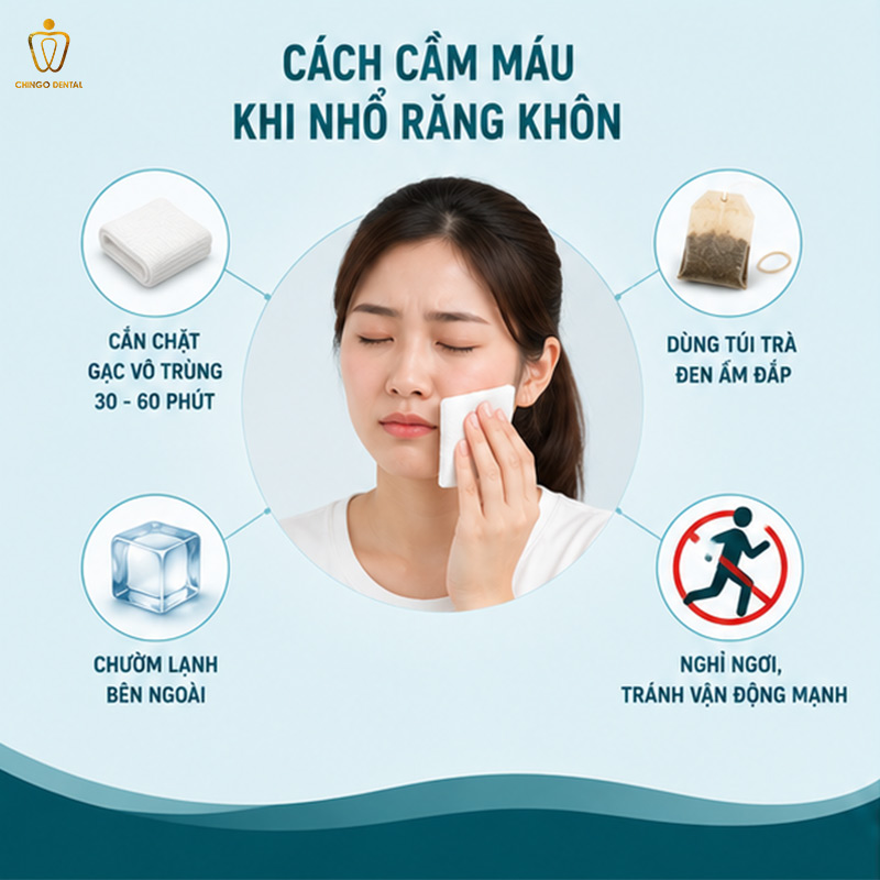 Cách Cầm Máu Khi Nhổ Răng: Hướng Dẫn Nhanh Và Đúng Cách 3 cầm máu sau khi nhổ răng