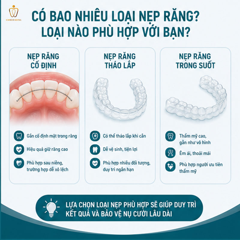 Nẹp Răng Là Gì? Các Loại, Quy Trình, Chi Phí & Những Điều Cần Biết Trước Khi Bắt Đầu 3 nẹp răng mất bao lâu