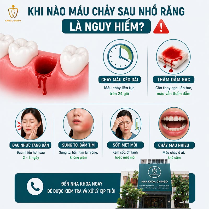 Cách Cầm Máu Khi Nhổ Răng: Hướng Dẫn Nhanh Và Đúng Cách 4 thuốc cầm máu sau nhổ răng