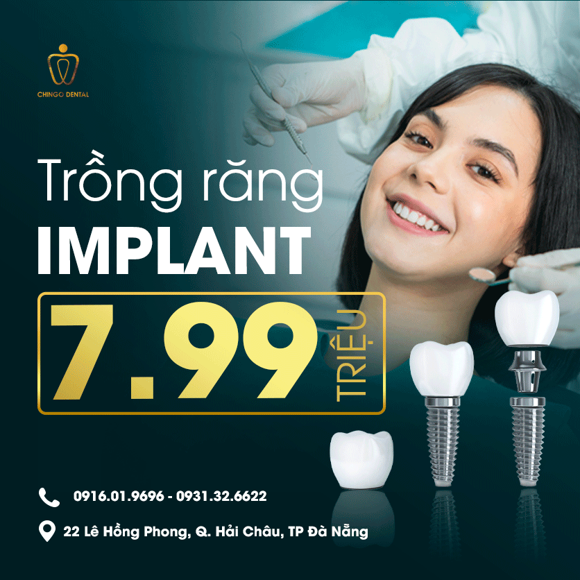implant chingo dental