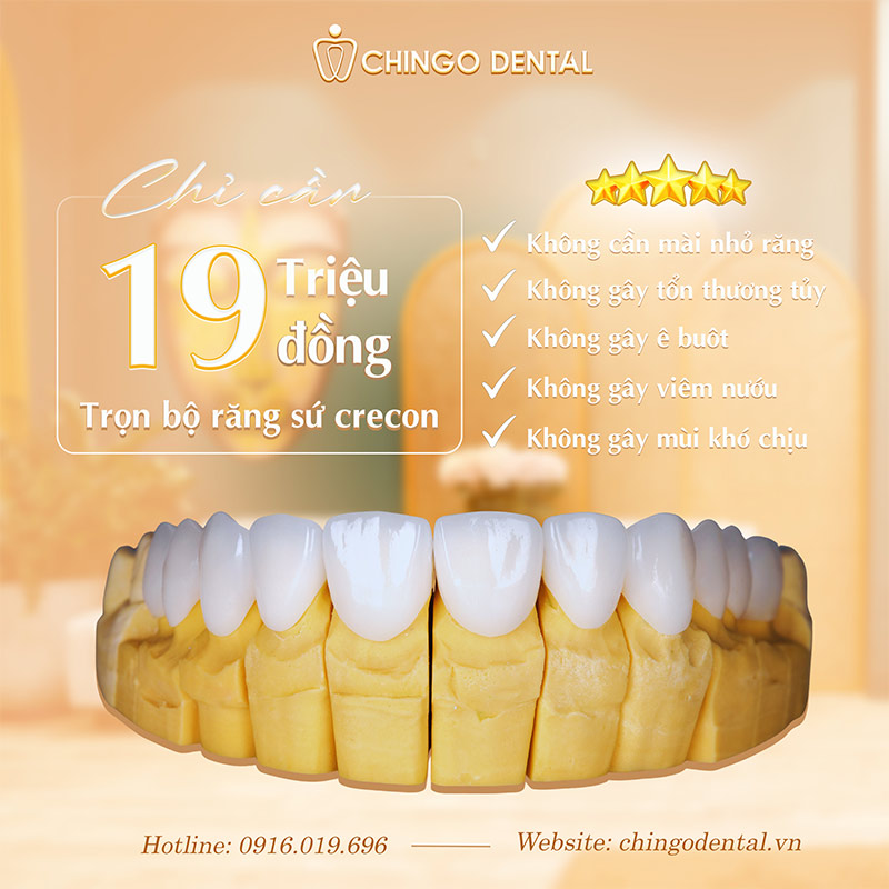 làm răng sứ bao nhiêu tiền