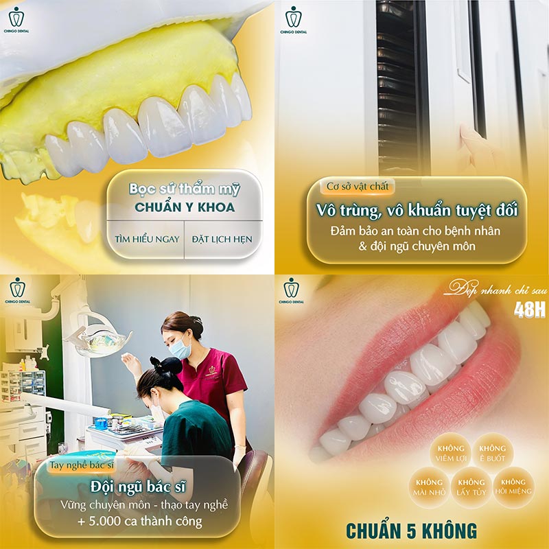 răng sứ giá bao nhiêu