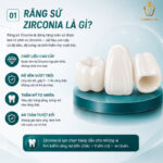 Giá Răng Sứ Zirconia Bao Nhiêu? Bảng Giá Chi Tiết, So Sánh & Toàn Bộ Thông Tin Cần Biết Răng sứ zirconia là gì