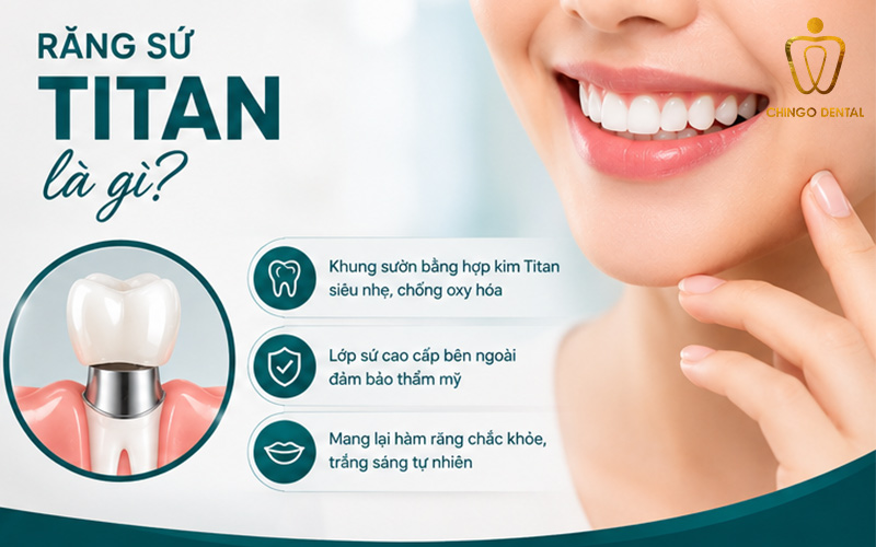 Răng Sứ Titan Là Gì? Ưu Nhược Điểm, Phân Loại & Bảng Giá Chi Tiết 5 bọc răng sứ titan