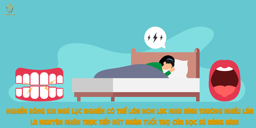 Bọc Răng Hàm Bị Sâu: Loại Sứ Nào Bền Nhất, Giá Bao Nhiêu Và Khi Nào Nên Làm? 4 bọc sứ răng hàm bị đau không