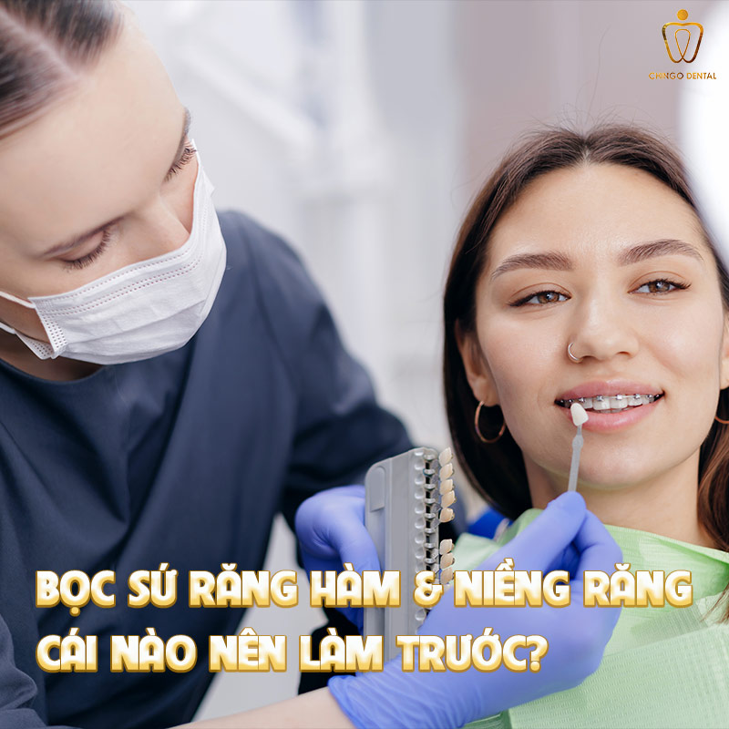 Bọc Răng Hàm Bị Sâu: Loại Sứ Nào Bền Nhất, Giá Bao Nhiêu Và Khi Nào Nên Làm? 5 bọc sứ răng hàm có bền không
