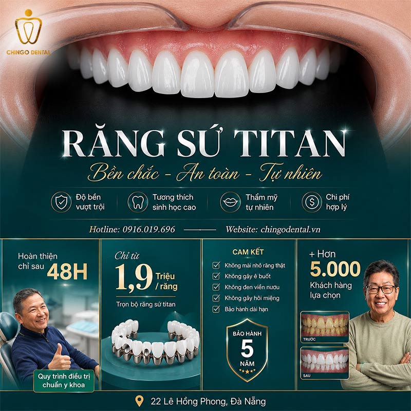 Răng Sứ Titan Là Gì? Ưu Nhược Điểm, Phân Loại & Bảng Giá Chi Tiết 4 răng sứ kim loại titan