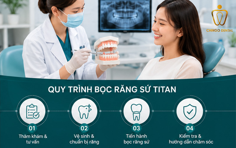 Răng Sứ Titan Là Gì? Ưu Nhược Điểm, Phân Loại & Bảng Giá Chi Tiết 3 răng sứ titan có tốt không