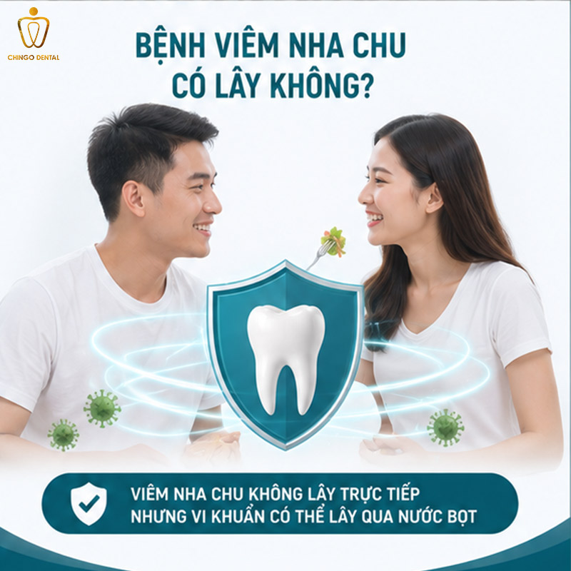 Bệnh Nha Chu Là Gì? Dấu Hiệu, Nguyên Nhân Và Cách Điều Trị Hiệu Quả 4 bệnh nha chu