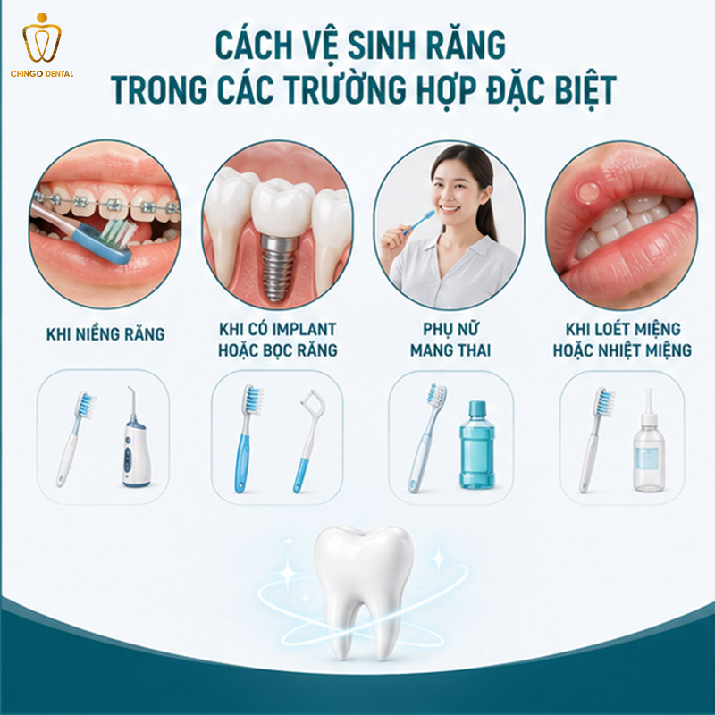 Thói Quen Chăm Sóc Răng Miệng Đúng Cách – Quy Trình Chuẩn Mỗi Ngày 3 chăm sóc răng miệng