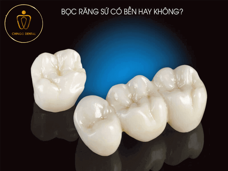 Bọc răng sứ có bền không? Tuổi thọ răng sứ là bao lâu? 4 bọc răng sứ có bền không