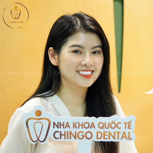 bọc răng sứ cho 2 răng cửa bị hô