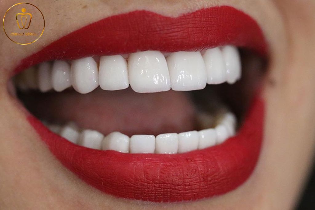 Răng sứ không bị biến đổi màu sắc theo thời gian