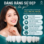 Dáng Răng Sứ Đẹp: Bí Quyết Chọn Form Răng Phù Hợp Để Nụ Cười Rạng Rỡ Nhất dáng răng sứ đẹp