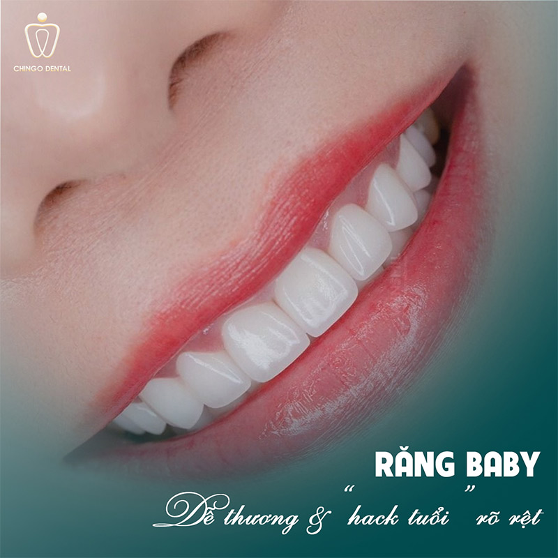 Dáng Răng Sứ Đẹp: Bí Quyết Chọn Form Răng Phù Hợp Để Nụ Cười Rạng Rỡ Nhất 6 răng baby