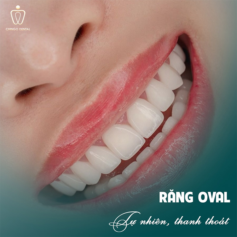 Dáng Răng Sứ Đẹp: Bí Quyết Chọn Form Răng Phù Hợp Để Nụ Cười Rạng Rỡ Nhất 3 răng oval