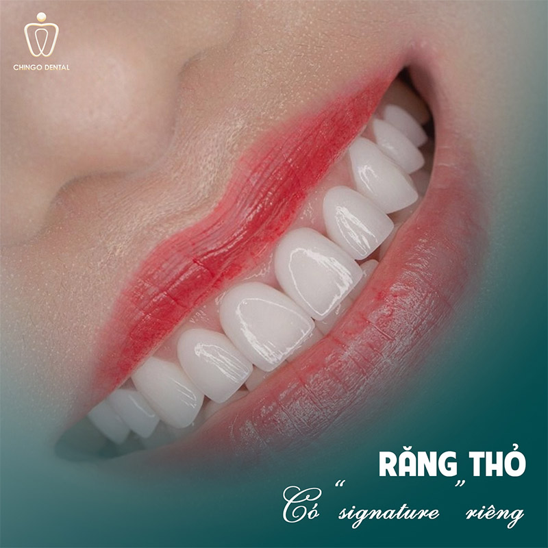 Dáng Răng Sứ Đẹp: Bí Quyết Chọn Form Răng Phù Hợp Để Nụ Cười Rạng Rỡ Nhất 4 Răng thỏ