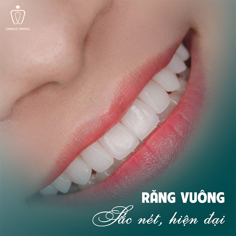 Dáng Răng Sứ Đẹp: Bí Quyết Chọn Form Răng Phù Hợp Để Nụ Cười Rạng Rỡ Nhất 5 Răng vuông