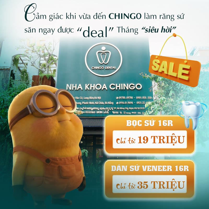 Bảng Giá Nha Khoa Đà Nẵng - Chingo Dental Mới Nhất 1 Bảng giá nha khoa Đà Nẵng