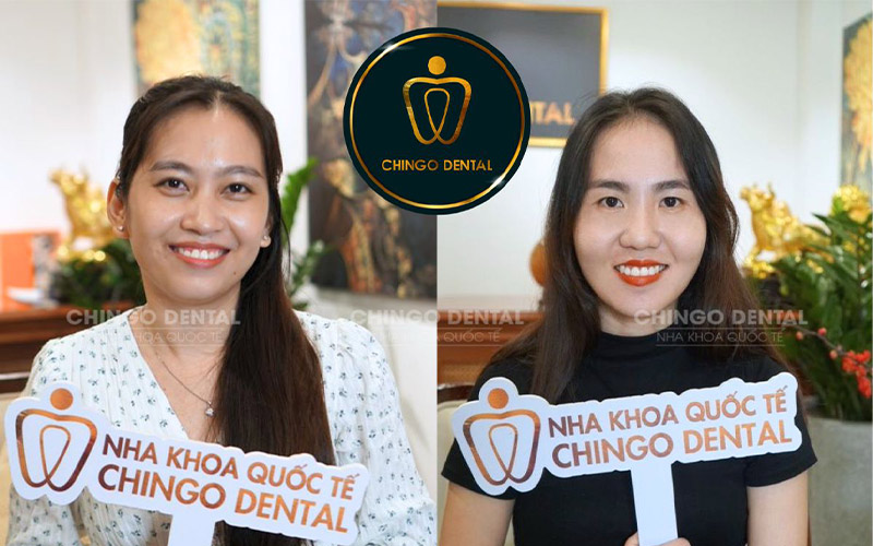 giá lấy cao răng Đà Nẵng