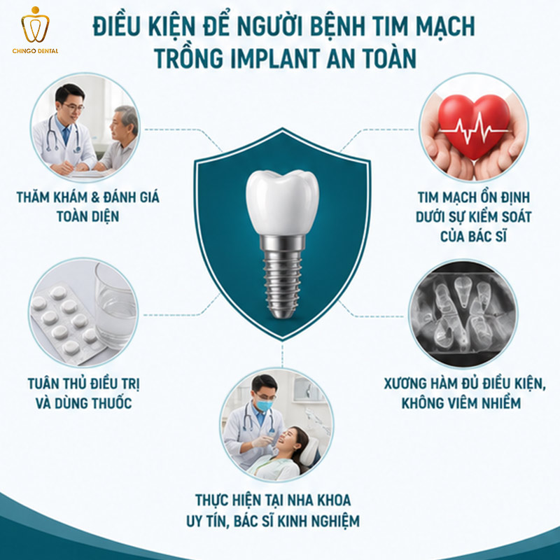 Bị Tim Mạch Có Trồng Răng Implant Được Không? Giải Đáp Từ Chuyên Gia 3 bệnh tim có cấy ghép implant được không