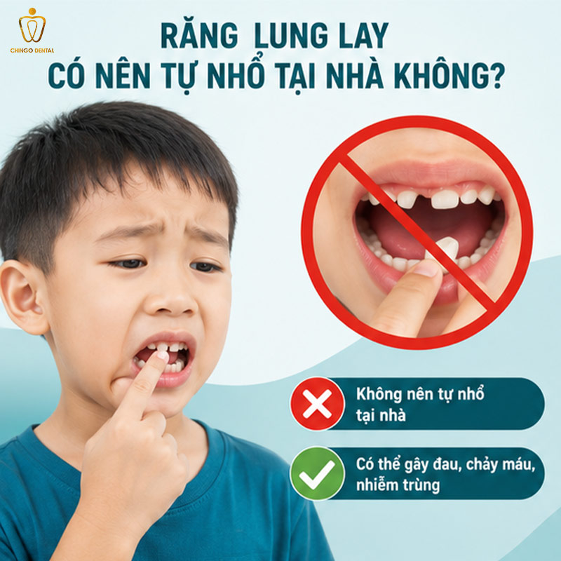 Cách Nhổ Răng Lung Lay Không Đau Tại Nhà - An Toàn, Đúng Cách, Không Sợ Đau 21 cách nhổ răng lung lay không đau tại nhà