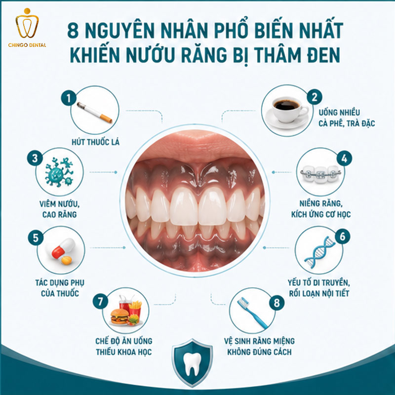 Nướu Răng Bị Thâm Đen: Nguyên Nhân, Dấu Hiệu Và Cách Điều Trị Hiệu Quả 49 chân răng bị đen