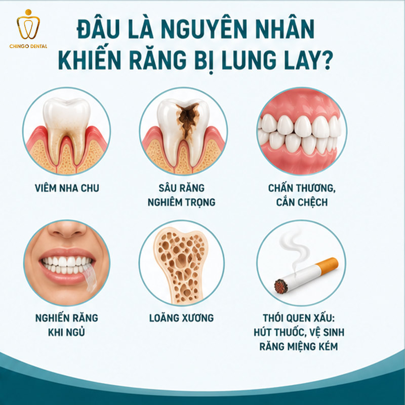 Răng Lung Lay Phải Làm Sao Để Chắc Lại? Nguyên Nhân Và Cách Xử Lý An Toàn Từ Chuyên Gia 2 lung lay răng