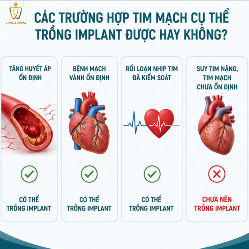 Bị Tim Mạch Có Trồng Răng Implant Được Không? Giải Đáp Từ Chuyên Gia 2 người bị tim mạch trồng implant được không