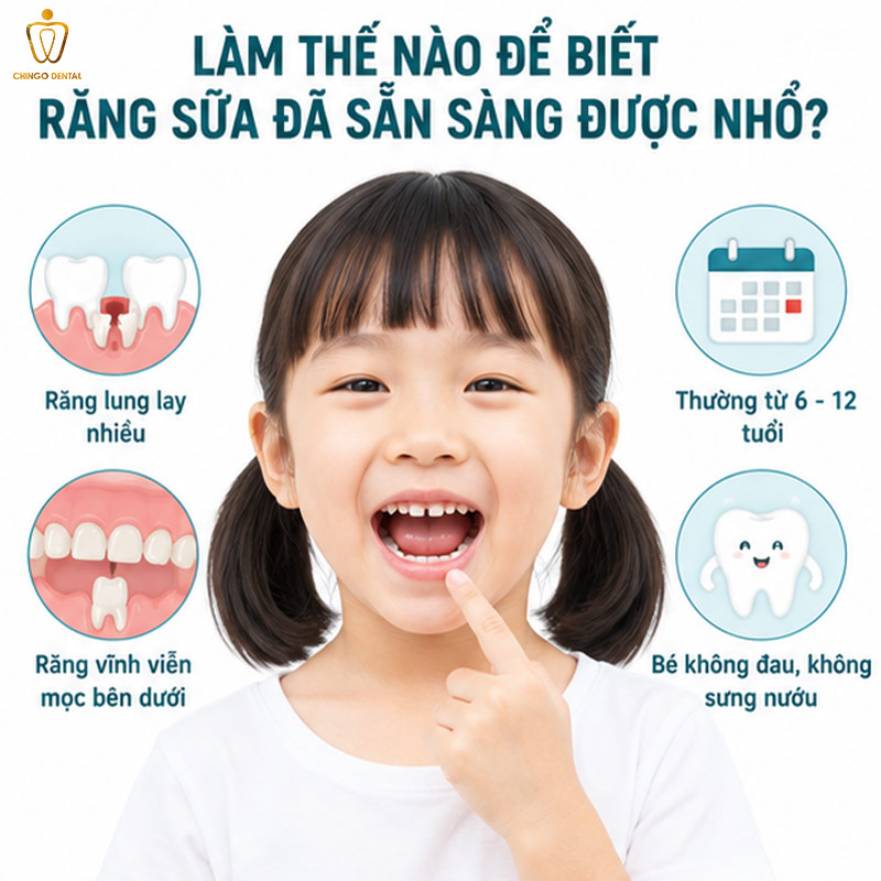 Cách Nhổ Răng Lung Lay Không Đau Tại Nhà - An Toàn, Đúng Cách, Không Sợ Đau 2 nhổ răng tại nhà