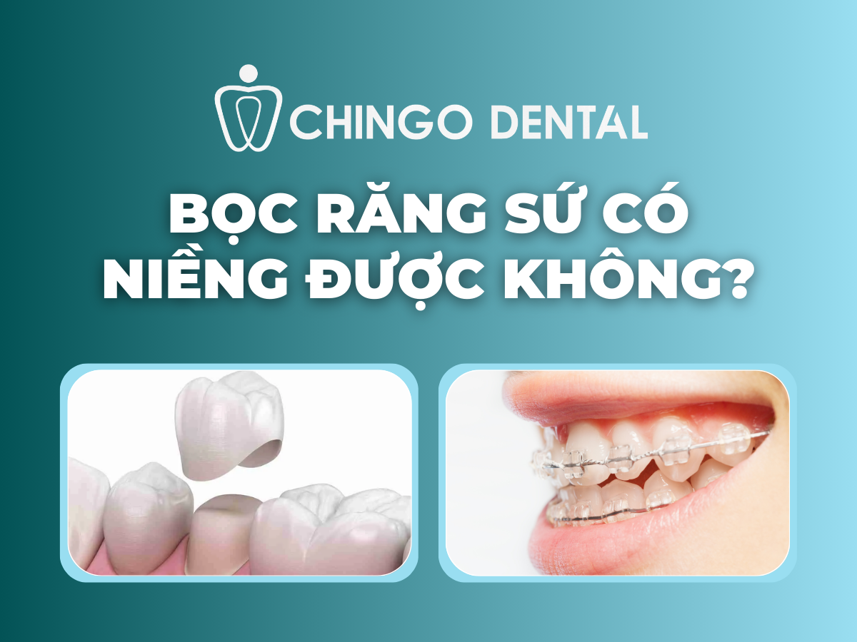 Bọc Răng Sứ Có Niềng Được Không? Giải Đáp Đầy Đủ Từ Thực Tế Lâm Sàng 1
